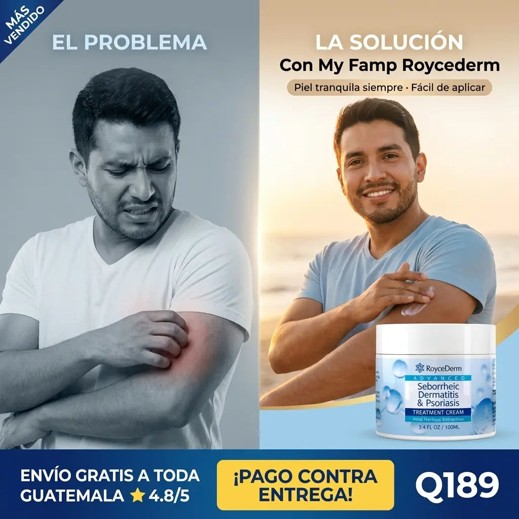 CREMA ROYCEDERM DERMATITIS Y PSORIASIS