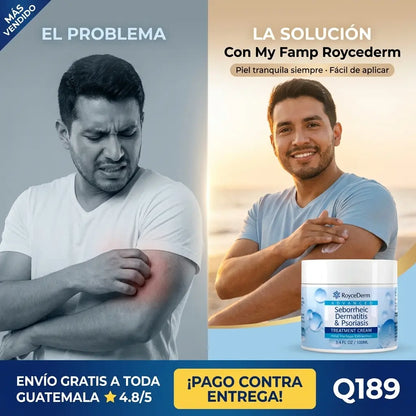 CREMA ROYCEDERM DERMATITIS Y PSORIASIS